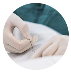 cirurgia endovascular