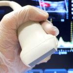 Ultrassom Doppler colorido arterial de membros superiores Ultrassom Doppler colorido arterial de membros superiores