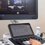 Ultrassom Doppler colorido de veia cava e veias ilíacas Ultrassom Doppler colorido de veia cava e veias ilíacas
